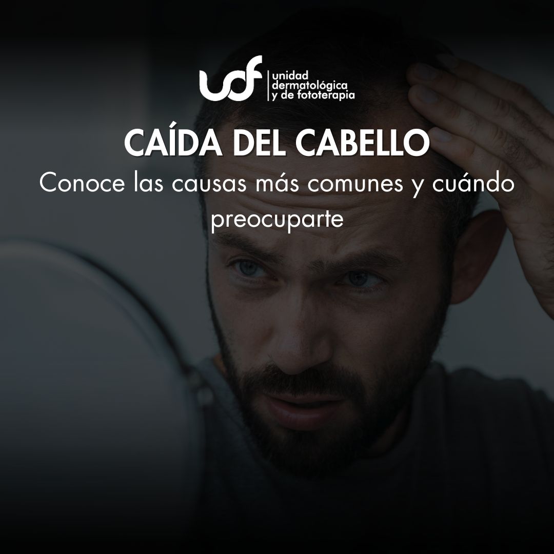 caída del cabello