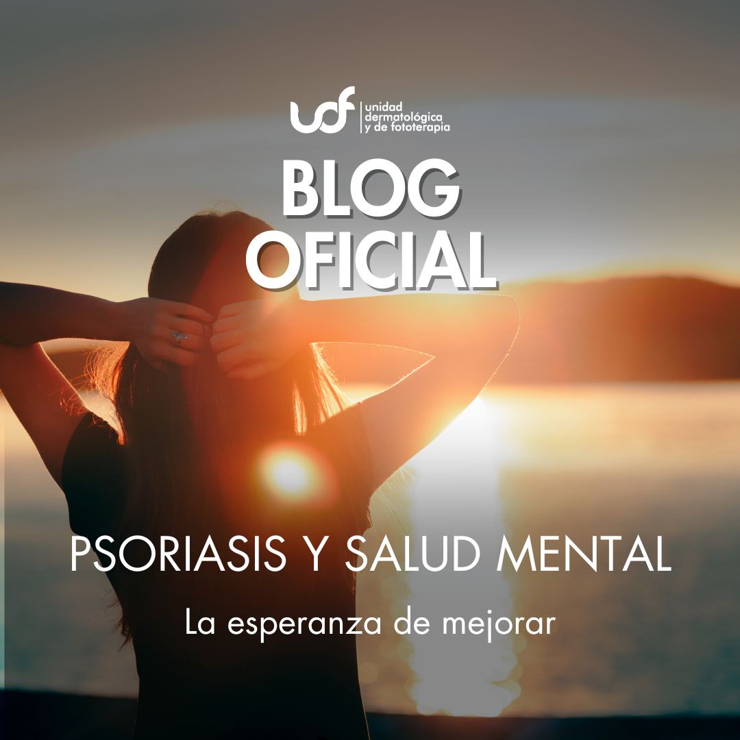 psoriasis que es y tratamiento